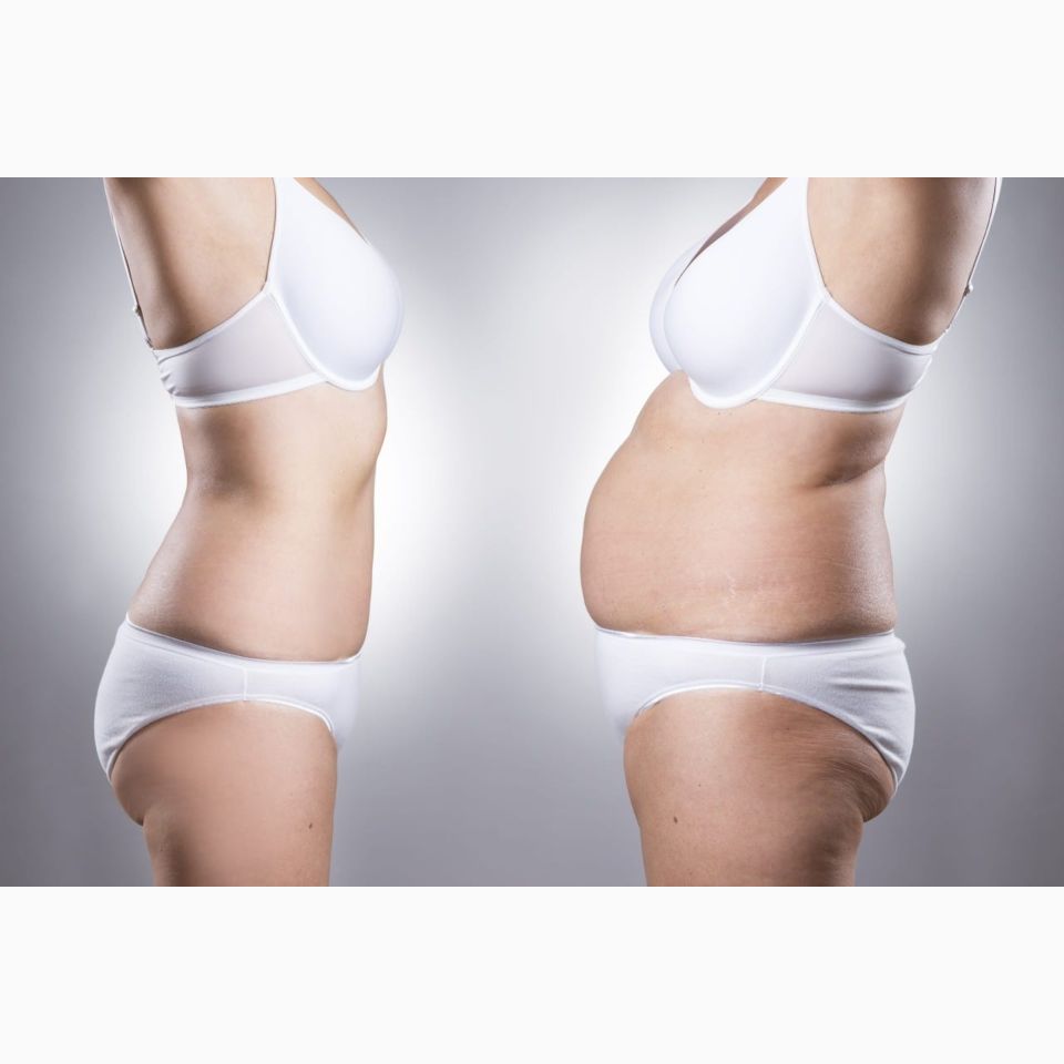 Dr. Jairo Zalamea Silva - Cirugía Plástica